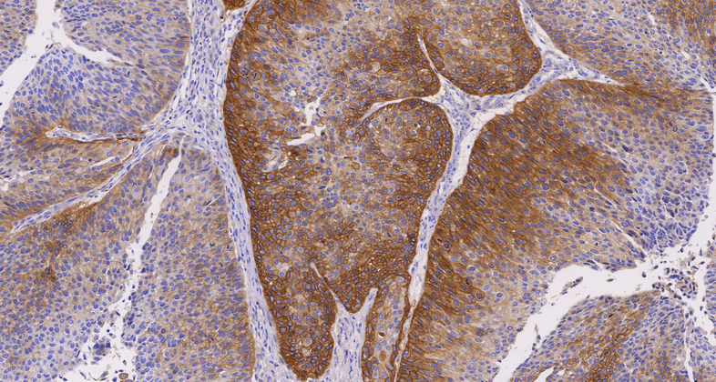 EGFR(EP22),RMab