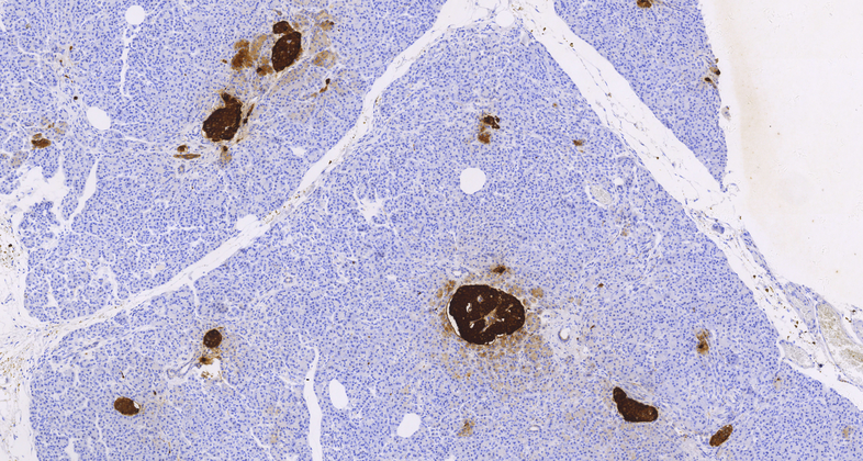 Chromogranin A (LK2H10),MMab