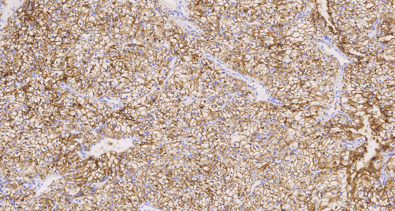 Carbonic Anhydrase 9 /(CAIX)(EP161), RMab