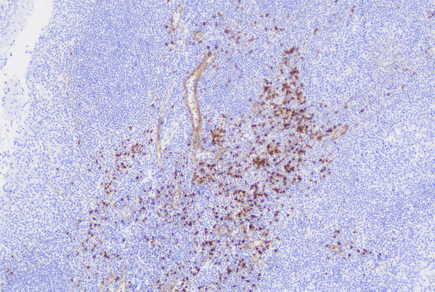 CD123(C3B5),MMab