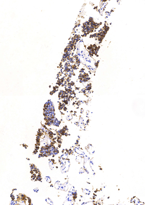 ACTH (Polyclonal), RPab