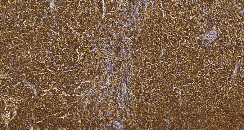 CD74(C4F8),MMab