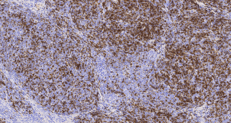 CD1a(EP80),RMab