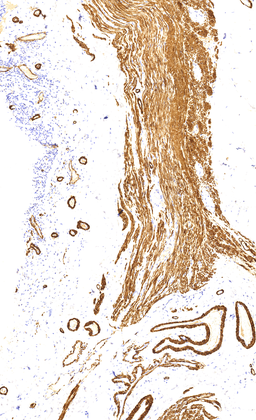 EMA (E29), MMab