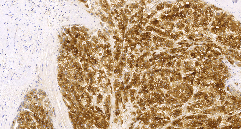 Alpha-1-Fetoprotein (C1B1),MMab