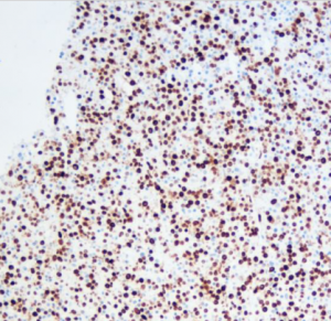 [Instrument] MicroStacker™ Flex Polymer Detection Kit