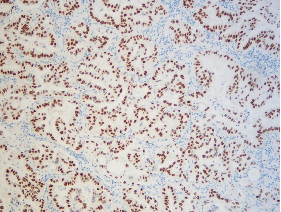 New Product – Fast Frozen IHC solution