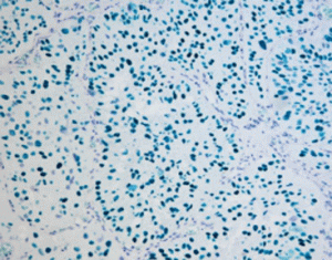 HRP-Blue Stain Reagent Kit