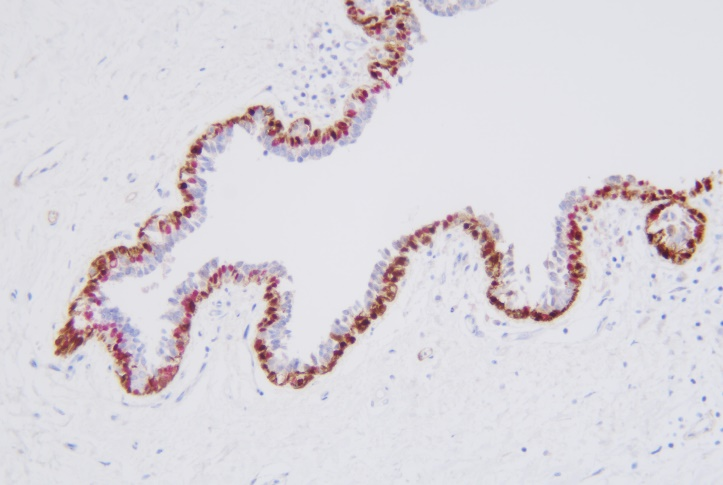 Calponin/p63 detection reagent (Immunohistochemical)