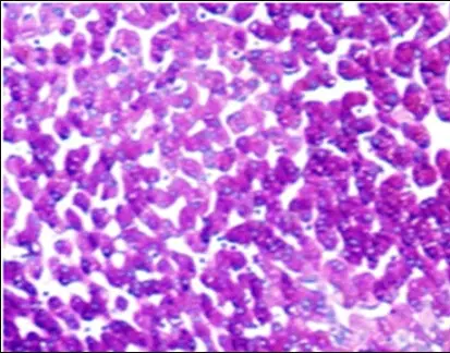 Exploring PAS Staining: Key Applications in Pathological Diagnosis