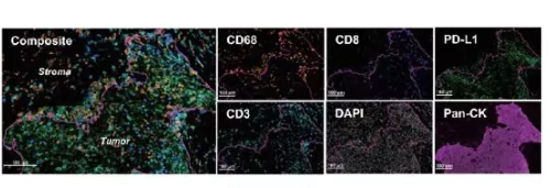 What Are Multiplex Immunohistochemical Kits (mIHC) Used For?