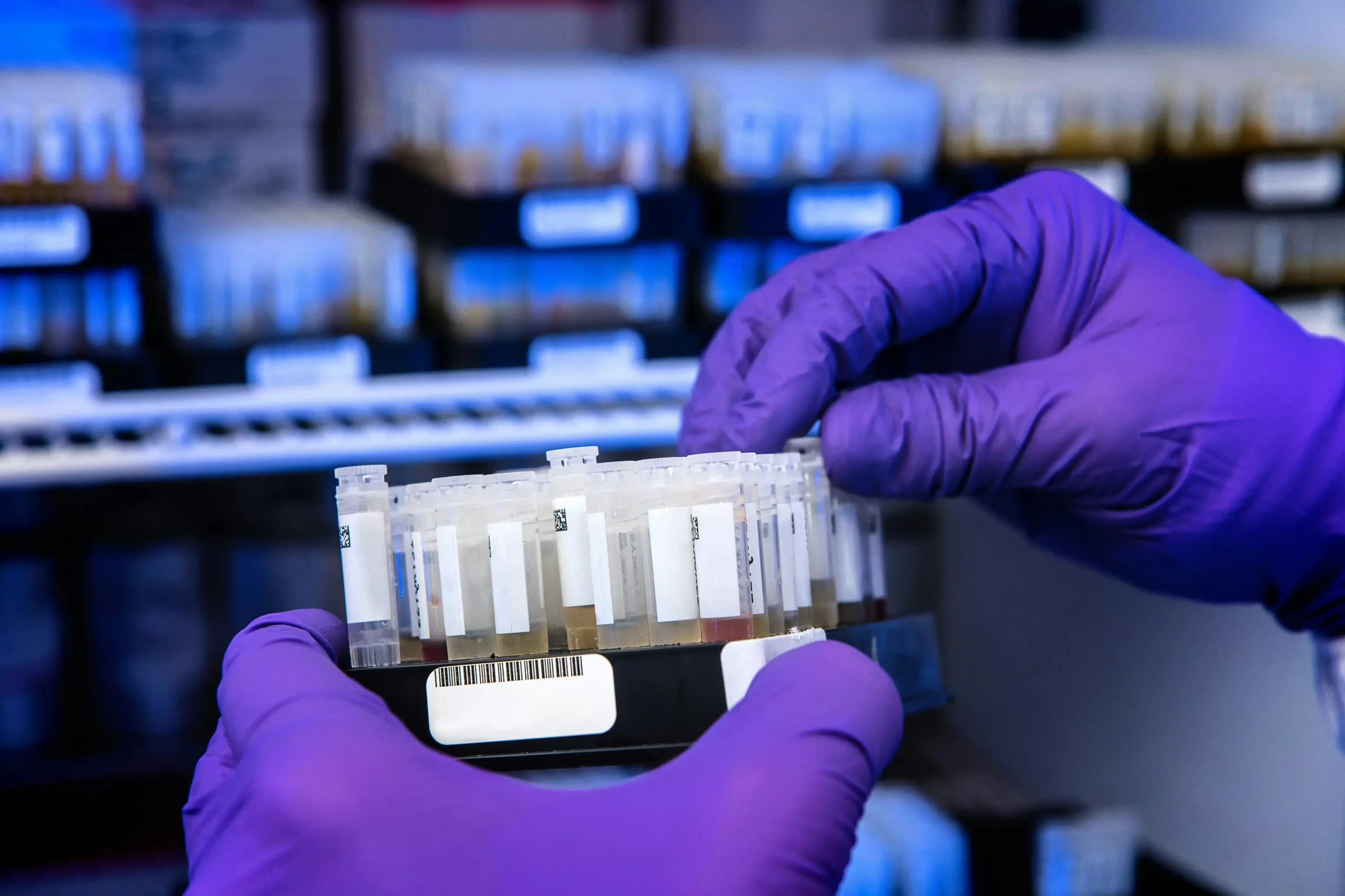 How Temperature Affects Primary Antibody Stability in Western Blotting