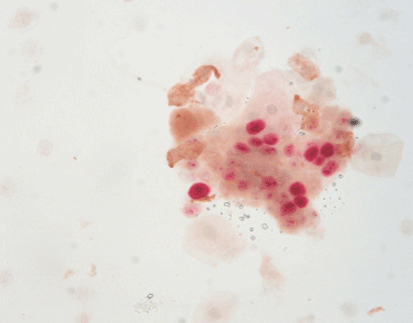 How to Interpret IHC Positive Results: A Guide for General Readers