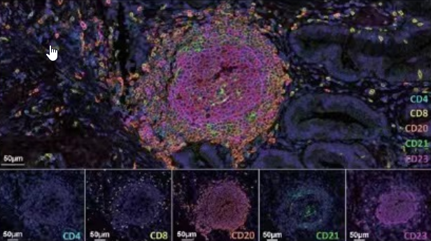 Advantages of mIHC Over Traditional IHC in Drug Development