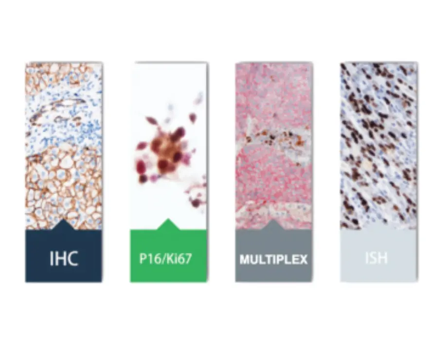 IHC Testing Process: Essential Steps and Insights for Beginners