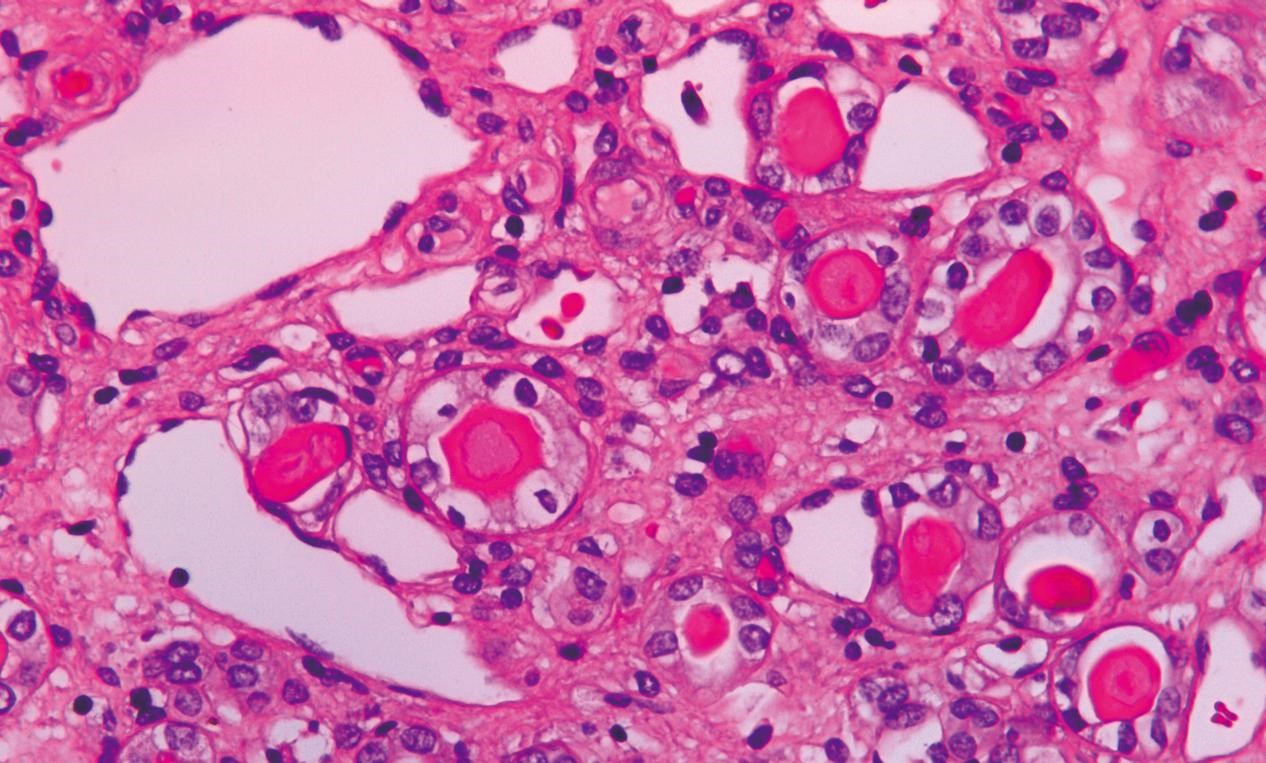 HE (Hematoxylin-Eosin) Staining Kit