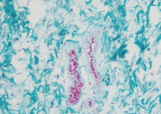 Trichrome-Masson Stain Kit