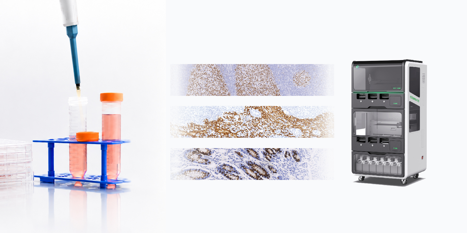 Immunohistochemistry