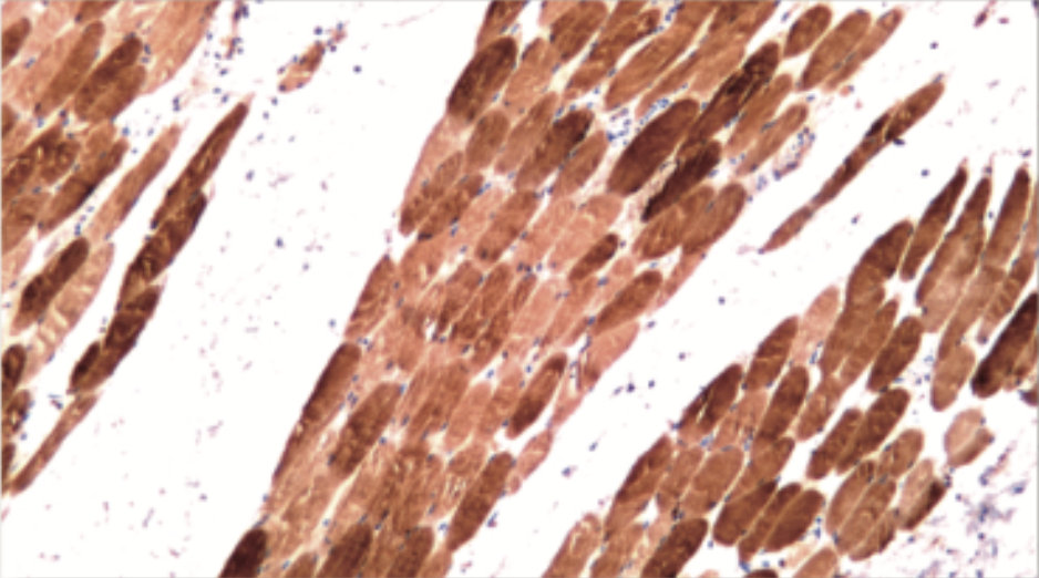 Myoglobin immunohistochemical staining in skeletal muscle
