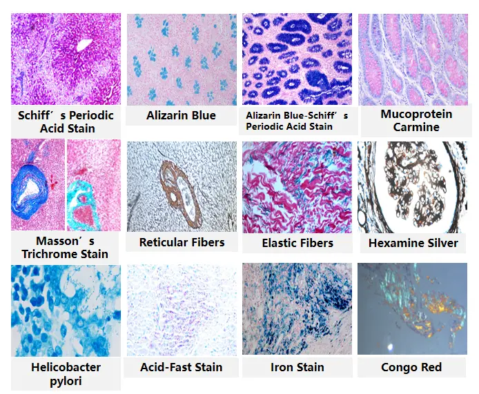 immunohistochemistry staining