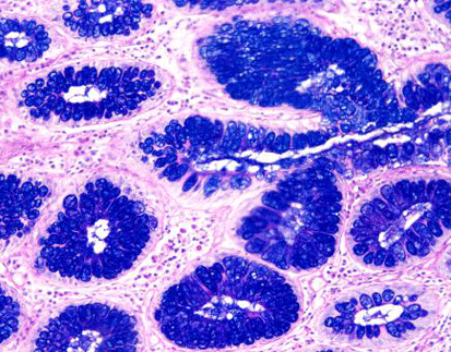 AB-PAS Staining Kit