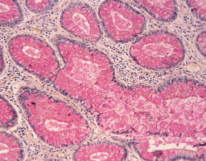 Mucicarmine Staining Kit