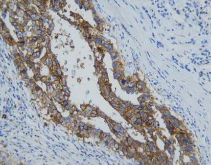 CD30,anti-mouse,monoclonal, C5E10