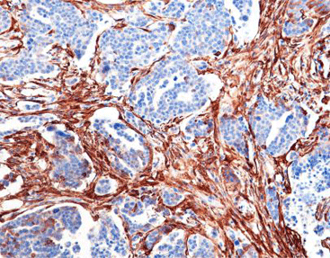 Smooth Muscle Actin(SMA)