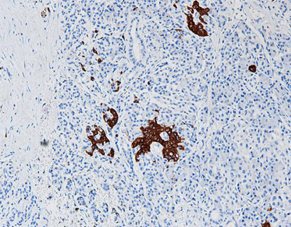 Synaptophysin (SYN),anti-rabbit,monoclonal,MRQ-40