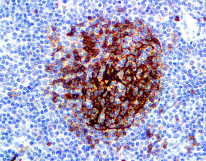 CD23,anti-rabbit,monoclonal,C3B11