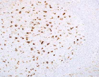 Alpha-1-Antichymotrypsin(AACT)