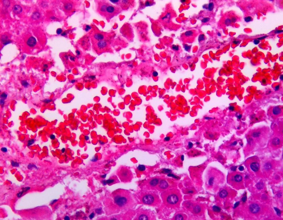 HE (Hematoxylin-Eosin) Staining Kit