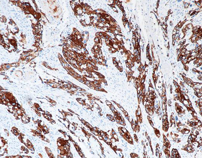 Cytokeratin14 CK14