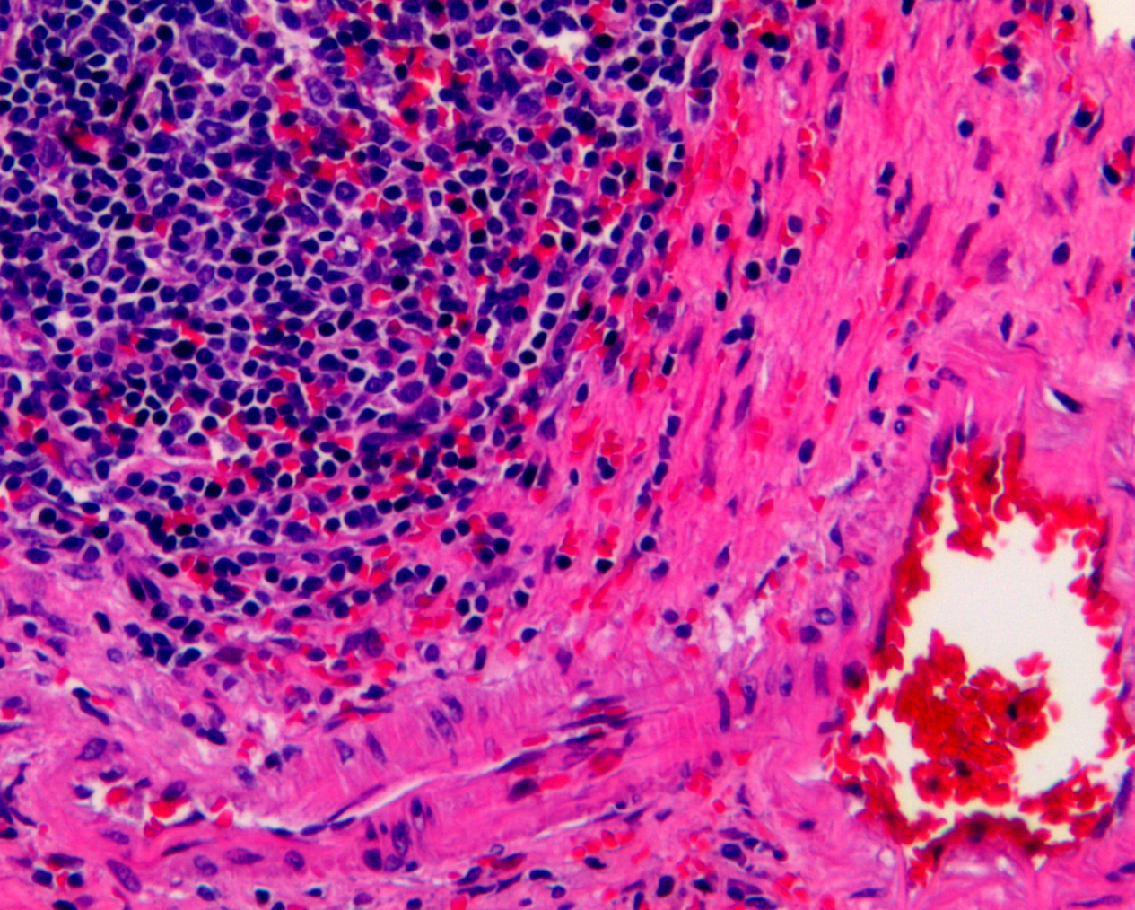 Hematoxylin Staining Solution