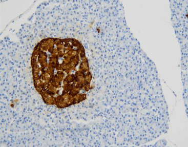 Chromogranin A(CgA)