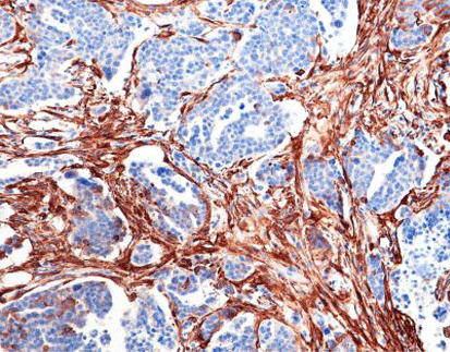 Smooth Muscle Actin(SMA)