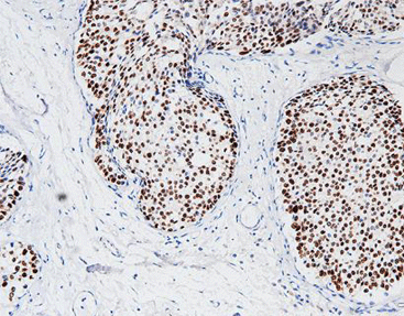 Progesterone Receptor