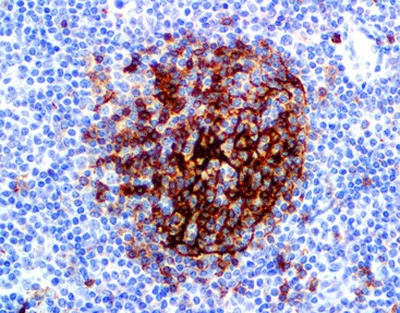 CD23,anti-rabbit,monoclonal,C3B11