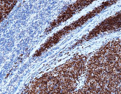 Terminal Deoxynucleotidyl Transferase(TDT)