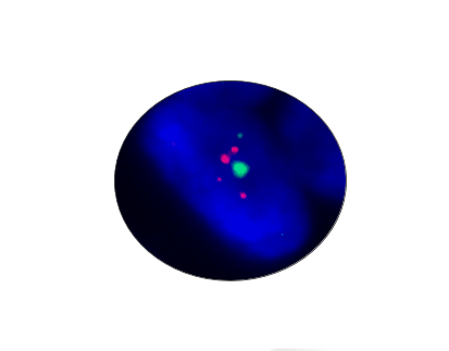 ZNF217 Gene Amplification Detection Kit