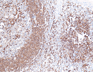 CD79a,anti-mouse,monoclonal,C4C4