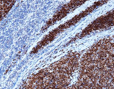 Terminal Deoxynucleotidyl Transferase(TDT)