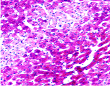 Periodic Acid-Schiff (PAS) Staining Kit