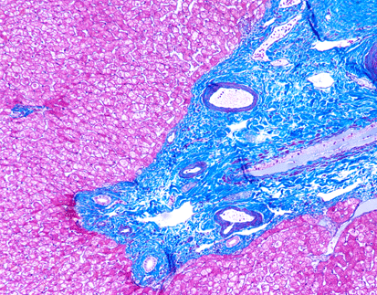 Masson Trichrome Staining Kit