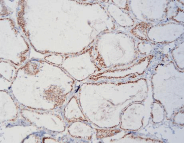 Celnovte CD56 NordiQC Assessment