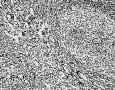 Reticular Fiber Staining Kit