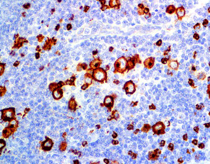 Celnovte CD15 NordiQC Assessment