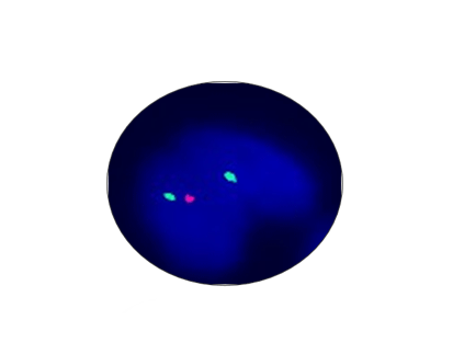 P53 Gene Detection Kit