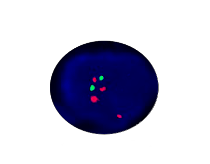 C-MYC(8q24) Gene Amplification Detection Kit