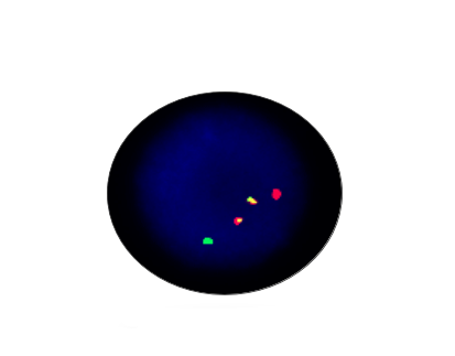 IGH/BCL2 Fusion Gene Detection Kit